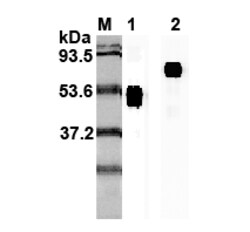 AdipoGen anti-IL-23p19 (human), mAb (I 178G) (50 µg), Quantity: Each of