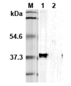 AdipoGen anti-Tim-3 (mouse), mAb (TI 339H) (100 µg), Quantity: Each of