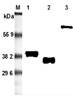 AdipoGen anti-Adiponectin (rat), mAb (RADI 264) (50 µg), Quantity: Each