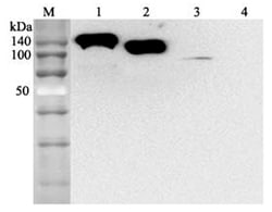 AdipoGen anti-ACE2 (human), mAb (AC384) (100 µg), Quantity: Each of 1