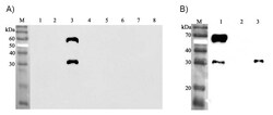 AdipoGen anti-ANGPTL3 (human), mAb (Kairos-37) (100 µg), Quantity: Each