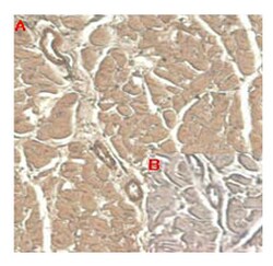 AdipoGen anti-IL-33 (human), mAb (IL33305B) (100 µg), Quantity: Each of