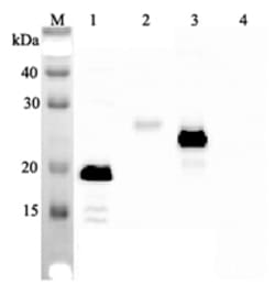 AdipoGen anti-IL-33, mAb (IL33026B) (50 µg), Quantity: Each of 1