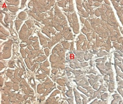AdipoGen anti-ST2 (human), mAb (ST33868) (50 µg), Quantity: Each of 1