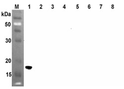 AdipoGen anti-ANGPTL4 (coiled-coil domain) (human), mAb (Kairos4-153AD)