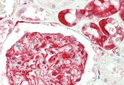 AdipoGen anti-Ribosomal Protein S3 (human), mAb (RP159-1) (100 µg), Quantity: