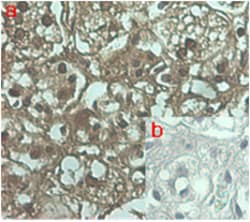 AdipoGen anti-ANGPTL7 (human), mAb (Kairos 108-4) (100 µg), Quantity: Each