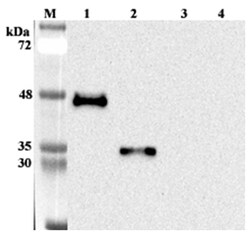AdipoGen anti-ANGPTL7 (human), mAb (Kairos 397-7) (100 µg), Quantity: Each