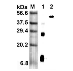 AdipoGen anti-RELM-alpha (mouse), mAb (MREL 127) (50 µg), Quantity: Each