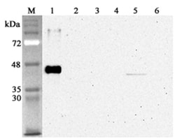 AdipoGen anti-Sirtuin 2 (human), mAb (S2R233-1) (100 µg), Quantity: Each