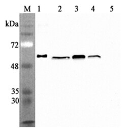 AdipoGen anti-Calreticulin (human), mAb (CR213-2AG) (100 µg), Quantity: