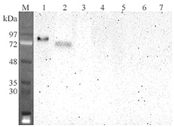AdipoGen anti-DLL4 (human), mAb (DL86-3AG) (100 µg), Quantity: Each of