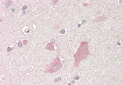 AdipoGen anti-NMNAT2 (human), mAb (Nady-1) (50 µg), Quantity: Each of 1