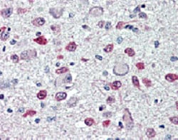 AdipoGen anti-FTO (human), mAb (AG103) (50 µg), Quantity: Each of 1
