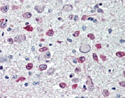 AdipoGen anti-FTO (human), mAb (AG103) (100 µg), Quantity: Each of 1