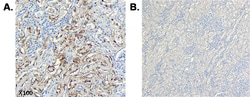 AdipoGen anti-CTRP6 (human), mAb (256-E) (50 µg), Quantity: Each of 1