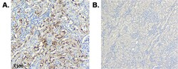 AdipoGen anti-CTRP6 (human), mAb (256-E) (100 µg), Quantity: Each of 1