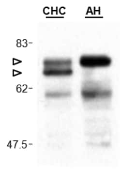 AdipoGen anti-Cardif (human), mAb (Adri-1) (100 µg), Quantity: Each of