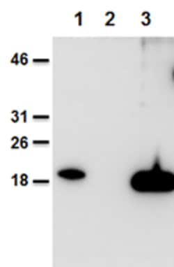 AdipoGen anti-IL-38, mAb (Nhat-1) (100 µg), Quantity: Each of 1