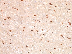 AdipoGen anti-Isocitrate Dehydrogenase 1 [IDH1] (R132H Mutant) (human),