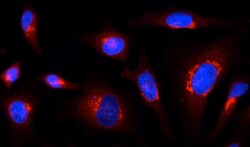 AdipoGen anti-Rab1-GTP, mAb (rec.) (ROF7) (100 µg), Quantity: Each of 1