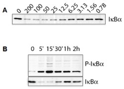 AdipoGen IL-1beta (human) (rec.) (untagged) (10 µg), Quantity: Each of