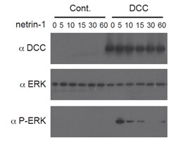 AdipoGen Netrin-1 (human):Fc (human) (rec.) (10 µg), Quantity: Each of