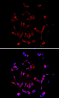 Biolegend Alexa Fluor 594 anti NF-H/NF-M, Hypophosphorylated, Quantity: