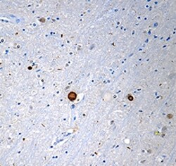 Biolegend Purified anti-α-Synuclein (C-Terminal Truncated x-122), Quantity:
