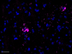 Biolegend Alexa Fluor 647 anti-Tau, 368-441, Quantity: Each of 1