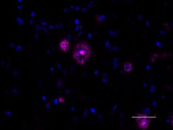 Biolegend Alexa Fluor 647 anti-β-Amyloid, aggregated, Quantity: Each of