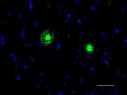 Biolegend Alexa Fluor 488 anti-β-Amyloid, aggregated, Quantity: Each of