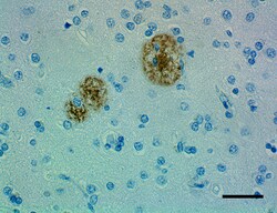 Biolegend Purified anti-β-Amyloid, aggregated, Quantity: Each of 1