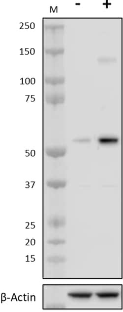 Biolegend Chloroquine Phosphate, Quantity: Each of 1
