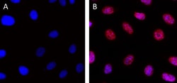 Biolegend Alexa Fluor 647 anti-H2A.X, Quantity: Each of 1
