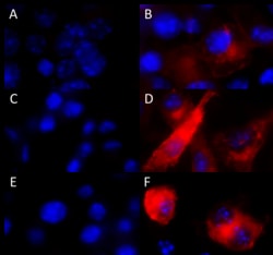 Biolegend Alexa Fluor 594 anti-Nos2 (iNOS), Quantity: Each of 1