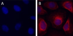 Biolegend Alexa Fluor 647 anti-Cytokeratin 17, Quantity: Each of 1