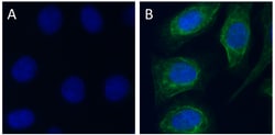 Biolegend Alexa Fluor 488 anti-Cytokeratin 17, Quantity: Each of 1