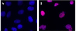 Biolegend Alexa Fluor 594 anti-Histone H3 Acetylated Lysine 9 (K9ac), Quantity: