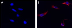 Biolegend Alexa Fluor 647 anti-Vimentin, Quantity: Each of 1