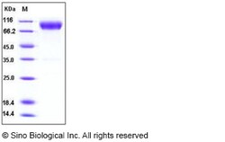 Sino Biological Recombinant Mouse CD200R Protein (His & hFc Tag), Quantity: