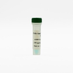 Revvity Health Sciences Inc HTRF pAb Anti-Human IgG d2-Conjugate, 20,000