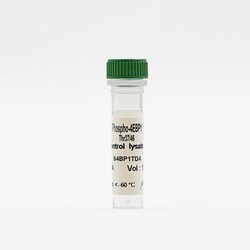 Revvity Health Sciences Inc HTRF Human & Mouse Phospho-4EBP1 (Thr37/46)