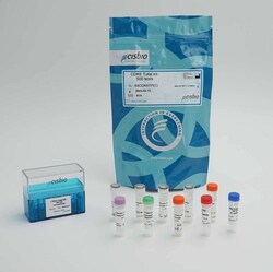 Revvity Health Sciences Inc&nbsp;HTRF Human Total CDK6 Detection Kit, 500 Assay Points