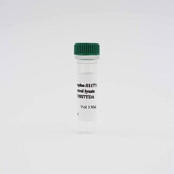Revvity Health Sciences Inc HTRF Human Phospho-eNOS (Ser1177) Detection