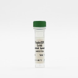 Revvity Health Sciences Inc HTRF Human Pan-Phospho- EGFR Detection Kit, Control Lysate