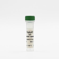 Revvity Health Sciences Inc&nbsp;HTRF Human & Mouse Phospho-NF-&kappa;B (Ser536) Detection Kit, Control Lysate