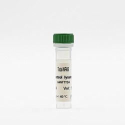 Revvity Health Sciences Inc HTRF Human B Detection Kit, Control Lysate,