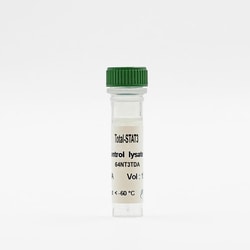 Revvity Health Sciences Inc HTRF Human & Mouse Total STAT3 Detection Kit,