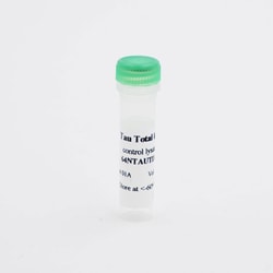 Revvity Health Sciences Inc HTRF Human Total Tau Detection Kit, Control